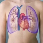 Heart-and-lungs
